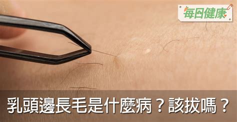 奶頭周圍長毛|乳頭邊長了毛，是什麼病？該不該拔？讓名醫一次解釋給您聽｜每